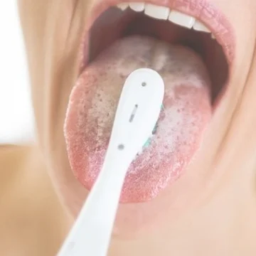 혀 백태 원인 제거방법
